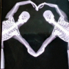 {skeleton}